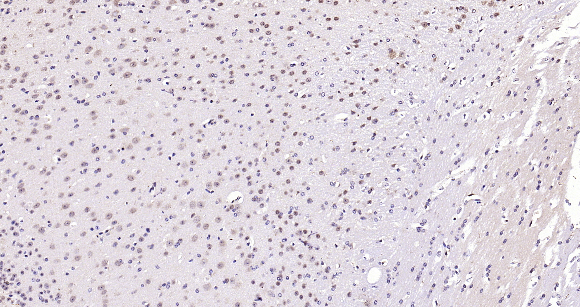 Paraformaldehyde-fixed, paraffin embedded Mouse brain; Antigen retrieval by boiling in sodium citrate buffer (pH6.0) for 15min; Block endogenous peroxidase by 3% hydrogen peroxide for 20 minutes; Blocking buffer (normal goat serum) at 37°C for 30min; Antibody incubation with RASSF2 Polyclonal Antibody, Unconjugated (bs-2939R) at 1:200 overnight at 4°C, DAB staining. Paraformaldehyde-fixed, paraffin embedded Mouse brain; Antigen retrieval by boiling in sodium citrate buffer (pH6.0) for 15min; Block endogenous peroxidase by 3% hydrogen peroxide for 20 minutes; Blocking buffer (normal goat serum) at 37°C for 30min; Antibody incubation with RASSF2 Polyclonal Antibody, Unconjugated (bs-2939R) at 1:200 overnight at 4°C, DAB staining.