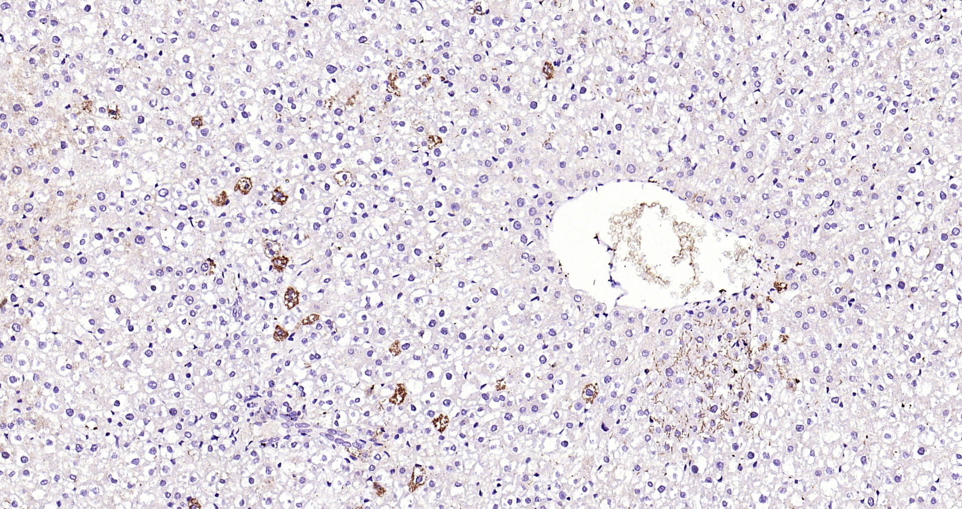 Paraformaldehyde-fixed, paraffin embedded Rat liver; Antigen retrieval by boiling in sodium citrate buffer (pH6.0) for 15min; Block endogenous peroxidase by 3% hydrogen peroxide for 20 minutes; Blocking buffer (normal goat serum) at 37°C for 30min; Antibody incubation with RASSF2 Polyclonal Antibody, Unconjugated (bs-2939R) at 1:200 overnight at 4°C, DAB staining. Paraformaldehyde-fixed, paraffin embedded Rat liver; Antigen retrieval by boiling in sodium citrate buffer (pH6.0) for 15min; Block endogenous peroxidase by 3% hydrogen peroxide for 20 minutes; Blocking buffer (normal goat serum) at 37°C for 30min; Antibody incubation with RASSF2 Polyclonal Antibody, Unconjugated (bs-2939R) at 1:200 overnight at 4°C, DAB staining.