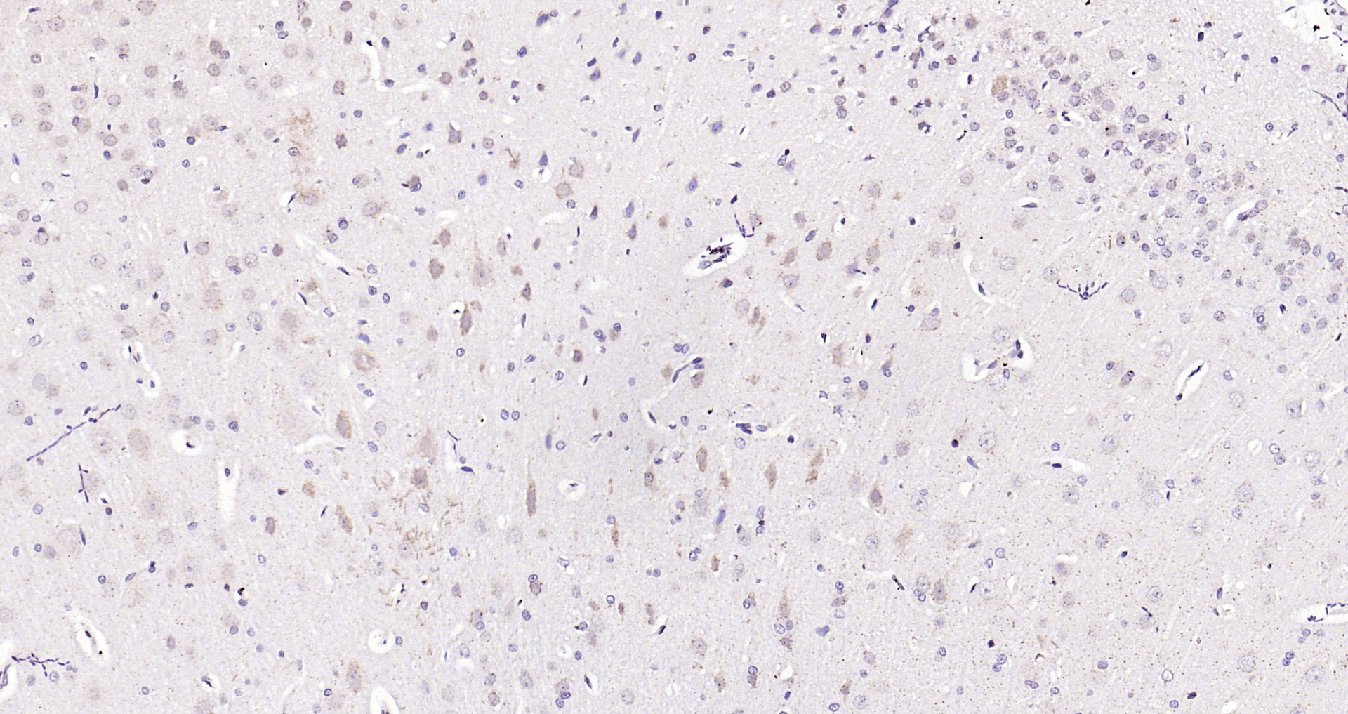 Paraformaldehyde-fixed, paraffin embedded Rat brain; Antigen retrieval by boiling in sodium citrate buffer (pH6.0) for 15min; Block endogenous peroxidase by 3% hydrogen peroxide for 20 minutes; Blocking buffer (normal goat serum) at 37°C for 30min; Antibody incubation with RASSF2 Polyclonal Antibody, Unconjugated (bs-2939R) at 1:200 overnight at 4°C, DAB staining. Paraformaldehyde-fixed, paraffin embedded Rat brain; Antigen retrieval by boiling in sodium citrate buffer (pH6.0) for 15min; Block endogenous peroxidase by 3% hydrogen peroxide for 20 minutes; Blocking buffer (normal goat serum) at 37°C for 30min; Antibody incubation with RASSF2 Polyclonal Antibody, Unconjugated (bs-2939R) at 1:200 overnight at 4°C, DAB staining.