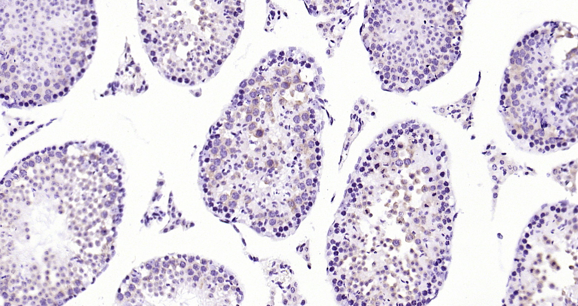 Paraformaldehyde-fixed, paraffin embedded Mouse testis; Antigen retrieval by boiling in sodium citrate buffer (pH6.0) for 15min; Block endogenous peroxidase by 3% hydrogen peroxide for 20 minutes; Blocking buffer (normal goat serum) at 37°C for 30min; Antibody incubation with MetAP1 Polyclonal Antibody, Unconjugated (bs-18806R) at 1:200 overnight at 4°C, DAB staining.