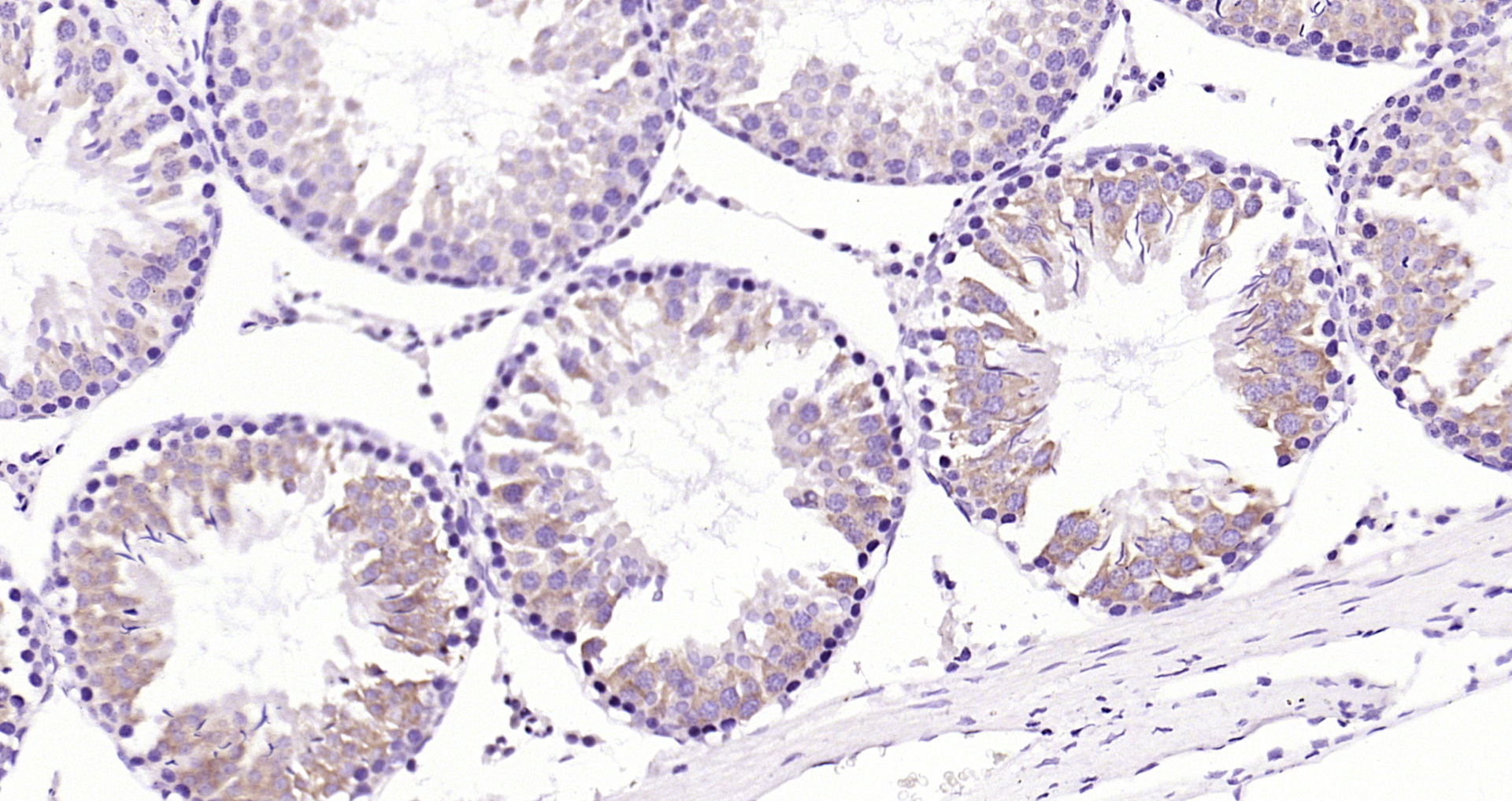 Paraformaldehyde-fixed, paraffin embedded Rat testis; Antigen retrieval by boiling in sodium citrate buffer (pH6.0) for 15min; Block endogenous peroxidase by 3% hydrogen peroxide for 20 minutes; Blocking buffer (normal goat serum) at 37°C for 30min; Antibody incubation with MetAP1 Polyclonal Antibody, Unconjugated (bs-18806R) at 1:200 overnight at 4°C, DAB staining.