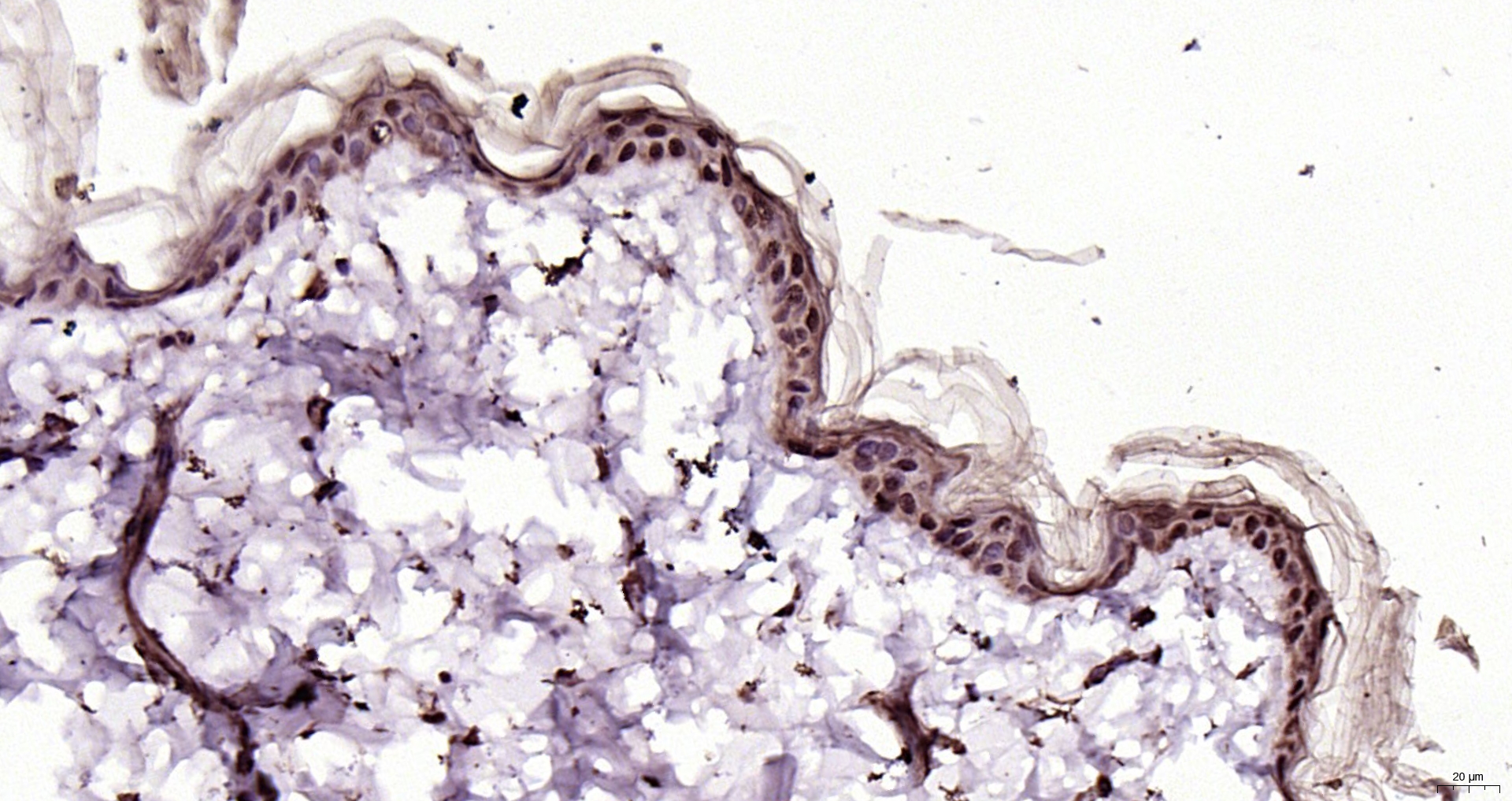 Paraformaldehyde-fixed, paraffin embedded Rat skin; Antigen retrieval by boiling in sodium citrate buffer (pH6.0) for 15min; Block endogenous peroxidase by 3% hydrogen peroxide for 20 minutes; Blocking buffer (normal goat serum) at 37°C for 30min; Antibody incubation with LASS3 Polyclonal Antibody, Unconjugated (bs-24624R) at 1:200 overnight at 4°C, DAB staining.