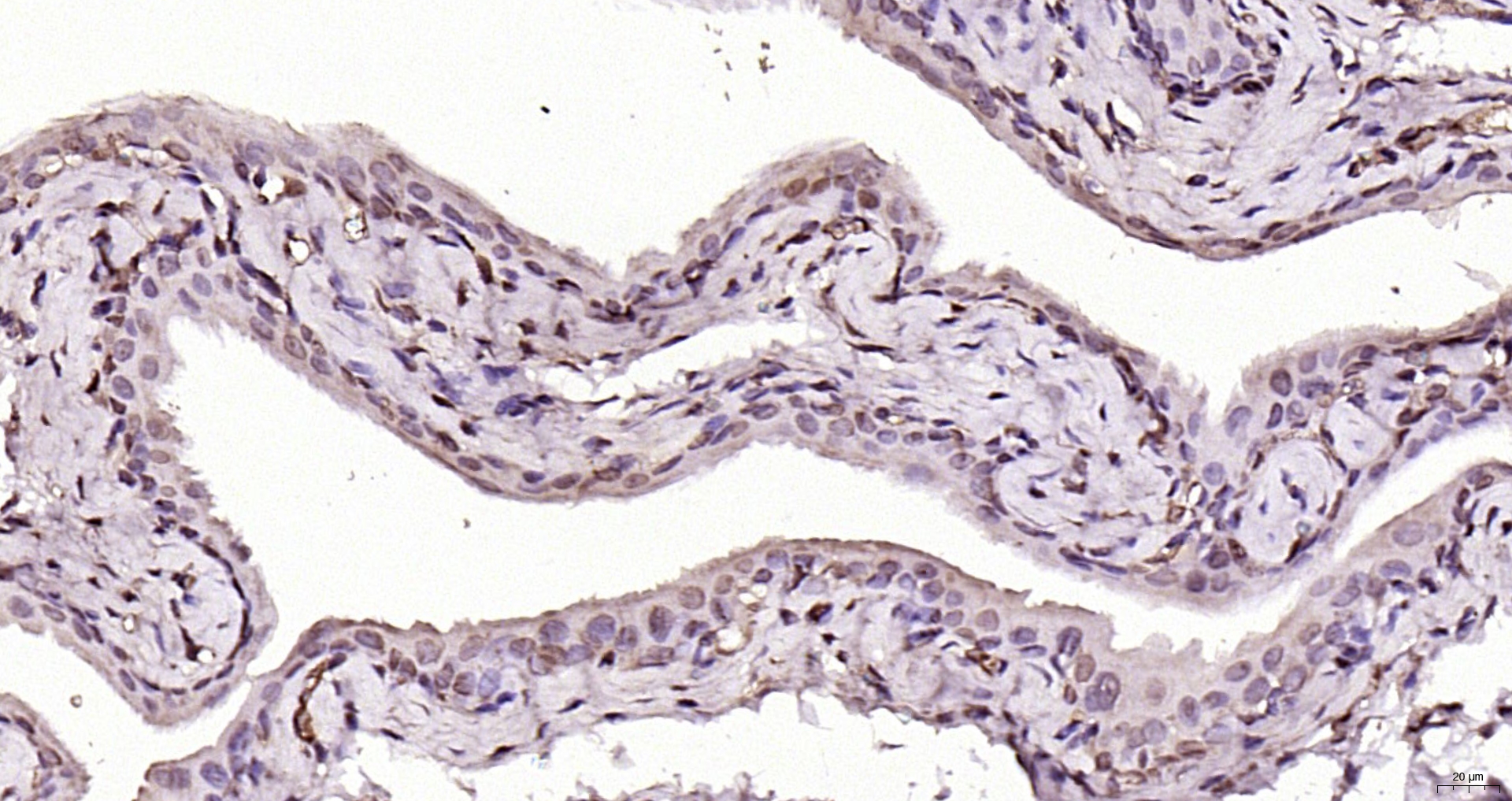 Paraformaldehyde-fixed, paraffin embedded Rat bladder; Antigen retrieval by boiling in sodium citrate buffer (pH6.0) for 15min; Block endogenous peroxidase by 3% hydrogen peroxide for 20 minutes; Blocking buffer (normal goat serum) at 37°C for 30min; Antibody incubation with MYCL Polyclonal Antibody, Unconjugated (bs-24627R) at 1:200 overnight at 4°C, DAB staining.