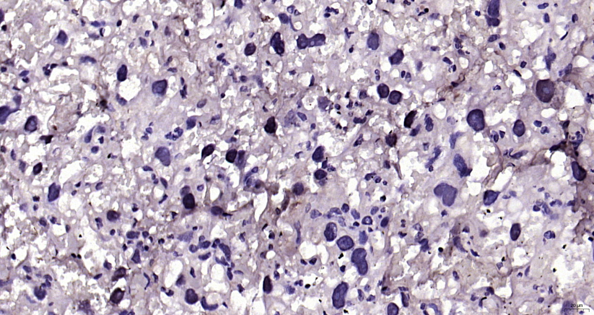 Paraformaldehyde-fixed, paraffin embedded Rat placenta; Antigen retrieval by boiling in sodium citrate buffer (pH6.0) for 15min; Block endogenous peroxidase by 3% hydrogen peroxide for 20 minutes; Blocking buffer (normal goat serum) at 37°C for 30min; Antibody incubation with MYCL Polyclonal Antibody, Unconjugated (bs-24627R) at 1:200 overnight at 4°C, DAB staining.