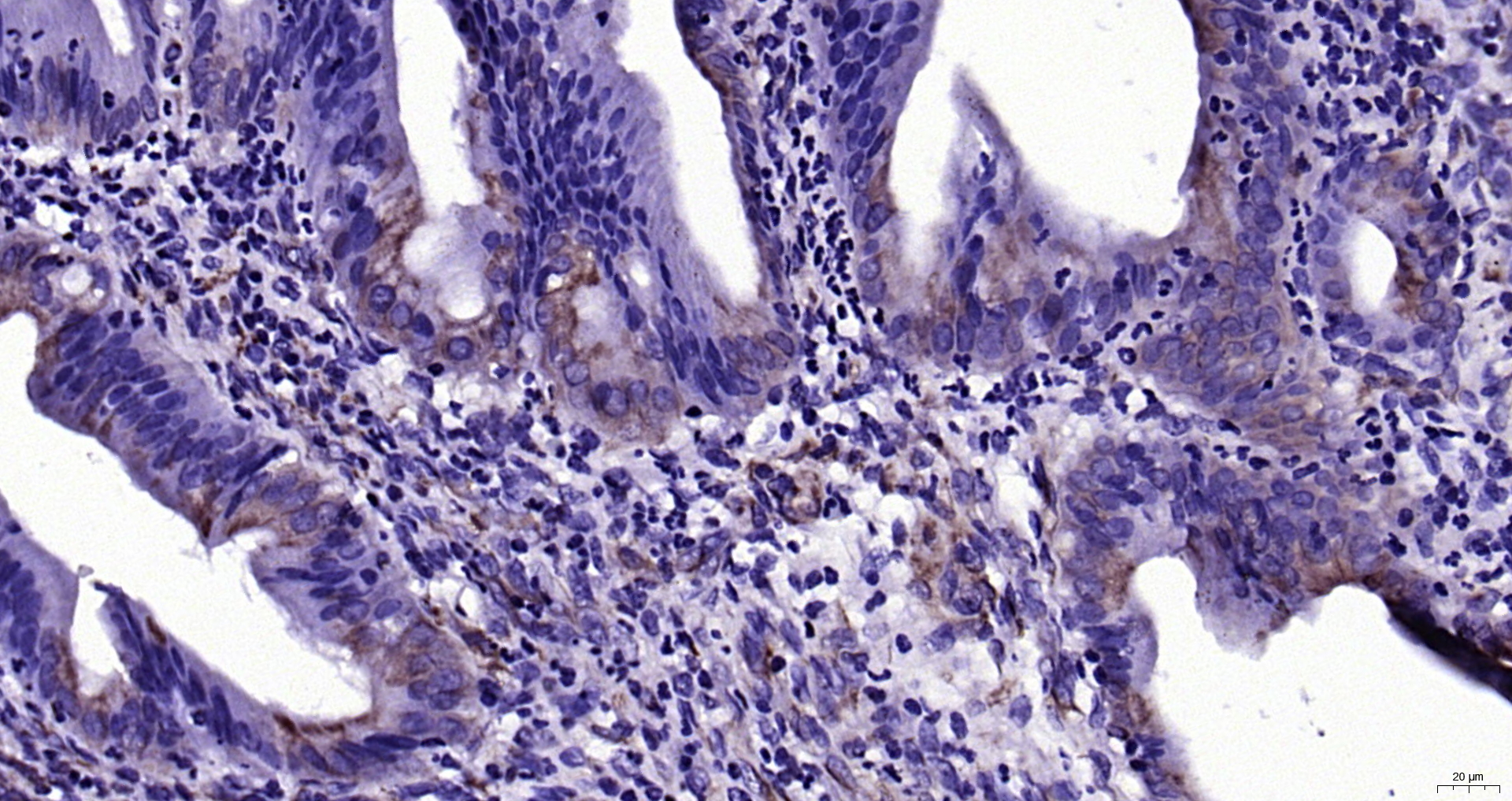 Paraformaldehyde-fixed, paraffin embedded Human gall bladder; Antigen retrieval by boiling in sodium citrate buffer (pH6.0) for 15min; Block endogenous peroxidase by 3% hydrogen peroxide for 20 minutes; Blocking buffer (normal goat serum) at 37°C for 30min; Antibody incubation with Claudin 2 Monoclonal Antibody, Unconjugated (bsm-33414M) at 1:200 overnight at 4°C, DAB staining.