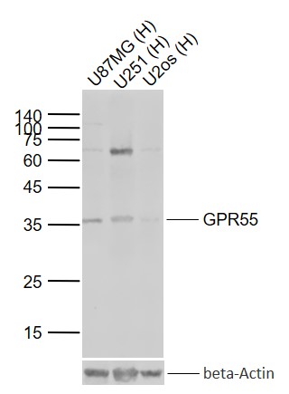 Lane 1: Human U87MG cell lysates; Lane 2: Human U251 cell lysates; Lane 3: Human U2os cell lysates probed with GPR55 Polyclonal Antibody, Unconjugated (bs-7686R) at 1:1000 dilution and 4°C overnight incubation. Followed by conjugated secondary antibody incubation at 1:20000 for 60 min at 37˚C.