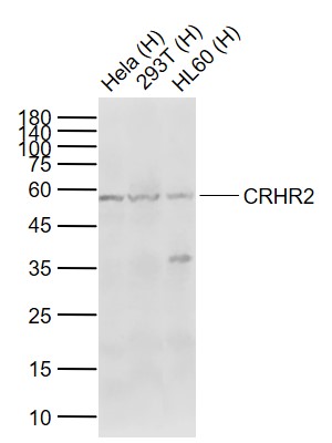 Lane 1: Human Hela cell lysates; Lane 2: Human 293T cell lysates; Lane 3: Human HL60 cell lysates probed with CRHR2 Polyclonal Antibody, Unconjugated (bs-2792R) at 1:1000 dilution and 4\u00b0C overnight incubation. Followed by conjugated secondary antibody incubation at 1:20000 for 60 min at 37˚C.