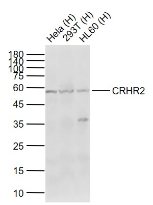 Lane 1: Human Hela cell lysates; Lane 2: Human 293T cell lysates; Lane 3: Human HL60 cell lysates probed with CRHR2 Polyclonal Antibody, Unconjugated (bs-2792R) at 1:1000 dilution and 4°C overnight incubation. Followed by conjugated secondary antibody incubation at 1:20000 for 60 min at 37˚C.