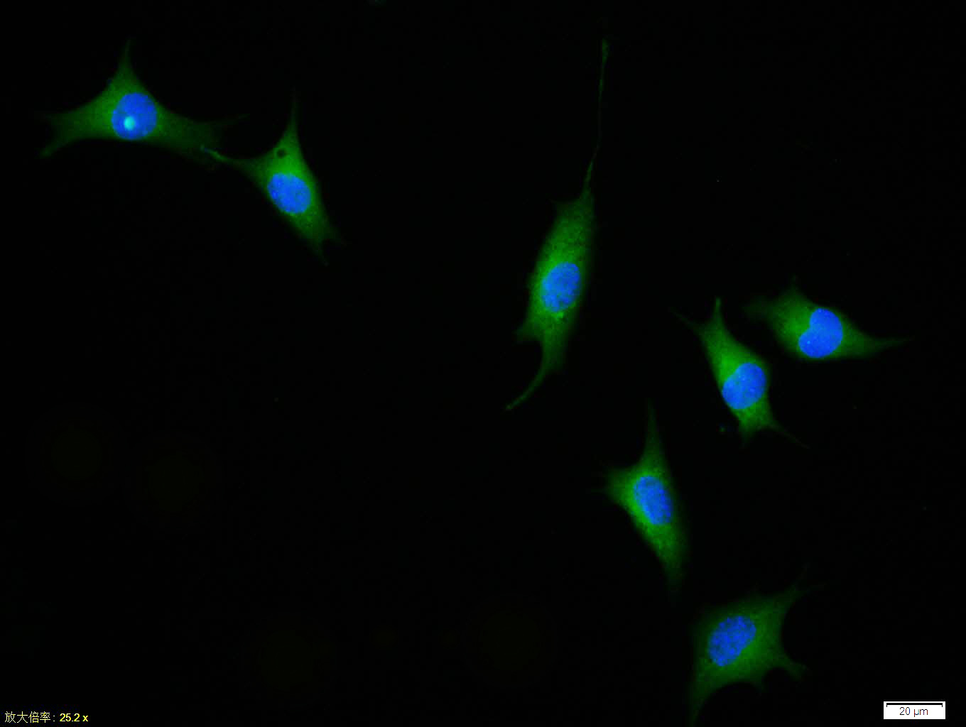 SH-SY5Y cell; 4% Paraformaldehyde-fixed; Triton X-100 at room temperature for 20 min; Blocking buffer (normal goat serum, C-0005) at 37°C for 20 min; Antibody incubation with (Elastin) polyclonal Antibody, Unconjugated (bs-1756R) 1:100, 90 minutes at 37°C; followed by a conjugated Goat Anti-Rabbit IgG antibody at 37°C for 90 minutes, DAPI (blue, C02-04002) was used to stain the cell nuclei.