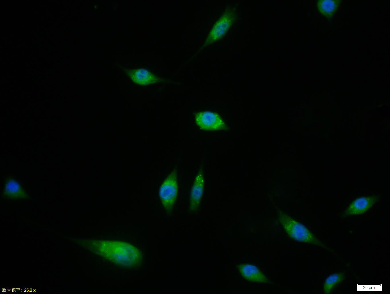 SH-SY5Y cell; 4% Paraformaldehyde-fixed; Triton X-100 at room temperature for 20 min; Blocking buffer (normal goat serum, C-0005) at 37°C for 20 min; Antibody incubation with (SPHK2) polyclonal Antibody, Unconjugated (bs-2653R) 1:100, 90 minutes at 37°C; followed by a conjugated Goat Anti-Rabbit IgG antibody at 37°C for 90 minutes, DAPI (blue, C02-04002) was used to stain the cell nuclei. SH-SY5Y cell; 4% Paraformaldehyde-fixed; Triton X-100 at room temperature for 20 min; Blocking buffer (normal goat serum, C-0005) at 37°C for 20 min; Antibody incubation with (SPHK2) polyclonal Antibody, Unconjugated (bs-2653R) 1:100, 90 minutes at 37°C; followed by a conjugated Goat Anti-Rabbit IgG antibody at 37°C for 90 minutes, DAPI (blue, C02-04002) was used to stain the cell nuclei.