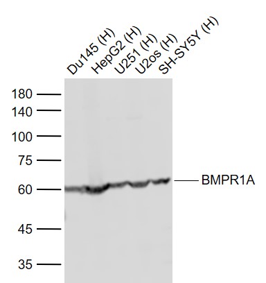 Lane 1: Human Du145 cell lysates; Lane 2: Human HepG2 cell lysates; Lane 3: Human U251 cell lysates; Lane 4: Human U2os cell lysates ; Lane 5: Human SH-SY5Y cell lysates probed with BMPR1A Polyclonal Antibody, Unconjugated (bs-1509R) at 1:1000 dilution and 4\u00b0C overnight incubation. Followed by conjugated secondary antibody incubation at 1:20000 for 60 min at 37˚C.