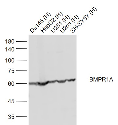 Lane 1: Human Du145 cell lysates; Lane 2: Human HepG2 cell lysates; Lane 3: Human U251 cell lysates; Lane 4: Human U2os cell lysates ; Lane 5: Human SH-SY5Y cell lysates probed with BMPR1A Polyclonal Antibody, Unconjugated (bs-1509R) at 1:1000 dilution and 4°C overnight incubation. Followed by conjugated secondary antibody incubation at 1:20000 for 60 min at 37˚C.