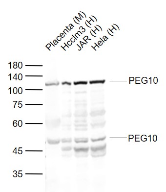 Lane 1: Mouse Placenta tissue lysates; Lane 2: Human Hcclm3 cell lysates; Lane 3: Human JAR cell lysates; Lane 4: Human Hela cell lysates probed with PEG10 Polyclonal Antibody, Unconjugated (bs-1084R) at 1:1000 dilution and 4°C overnight incubation. Followed by conjugated secondary antibody incubation at 1:20000 for 60 min at 37˚C.