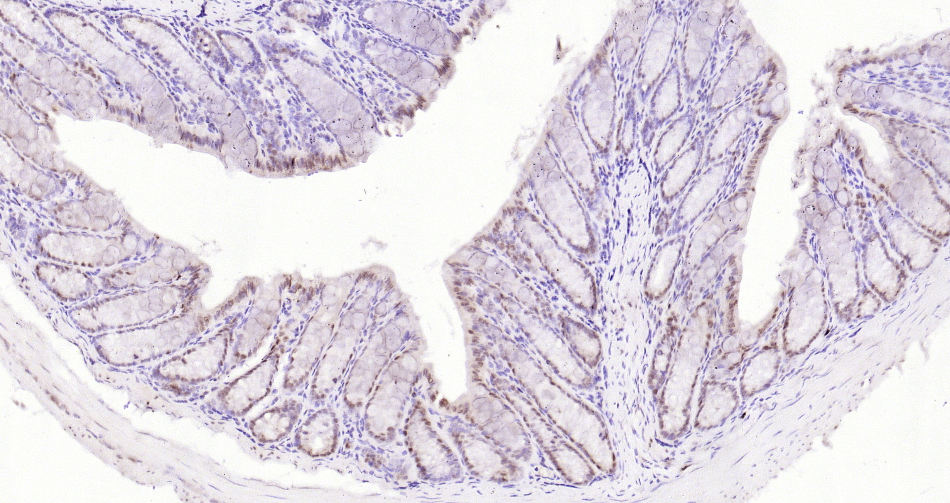 Paraformaldehyde-fixed, paraffin embedded Mouse colon; Antigen retrieval by boiling in sodium citrate buffer (pH6.0) for 15min; Block endogenous peroxidase by 3% hydrogen peroxide for 20 minutes; Blocking buffer (normal goat serum) at 37°C for 30min; Antibody incubation with IKK alpha Polyclonal Antibody, Unconjugated (bs-2907R) at 1:200 overnight at 4°C, DAB staining.