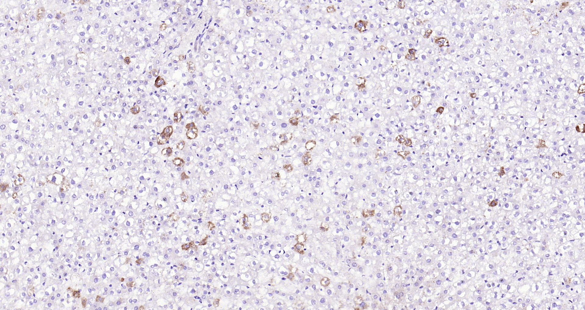 Paraformaldehyde-fixed, paraffin embedded Rat liver; Antigen retrieval by boiling in sodium citrate buffer (pH6.0) for 15min; Block endogenous peroxidase by 3% hydrogen peroxide for 20 minutes; Blocking buffer (normal goat serum) at 37°C for 30min; Antibody incubation with IKK alpha Polyclonal Antibody, Unconjugated (bs-2907R) at 1:200 overnight at 4°C, DAB staining.