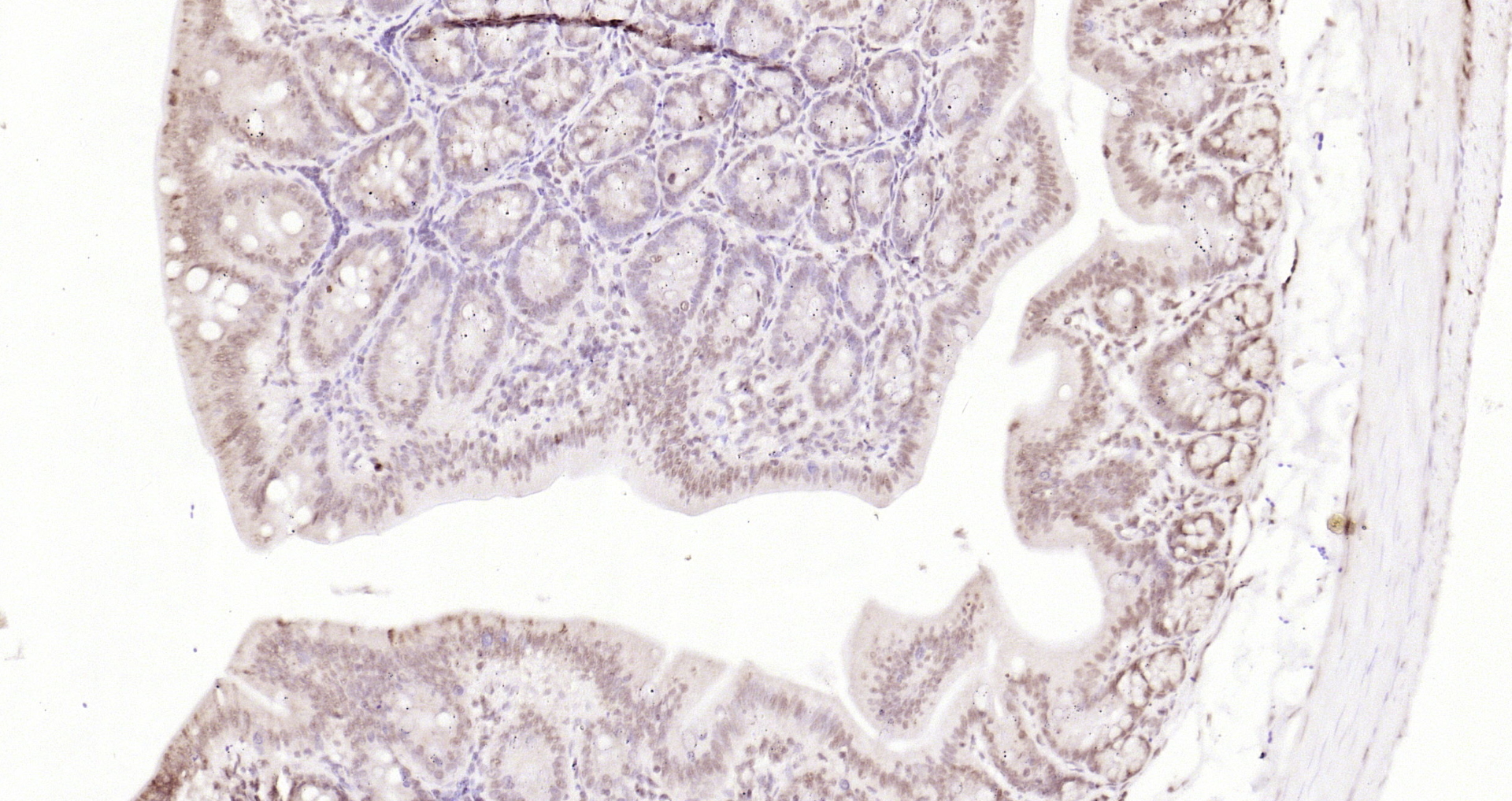 Paraformaldehyde-fixed, paraffin embedded Rat colon; Antigen retrieval by boiling in sodium citrate buffer (pH6.0) for 15min; Block endogenous peroxidase by 3% hydrogen peroxide for 20 minutes; Blocking buffer (normal goat serum) at 37°C for 30min; Antibody incubation with IKK alpha Polyclonal Antibody, Unconjugated (bs-2907R) at 1:200 overnight at 4°C, DAB staining.
