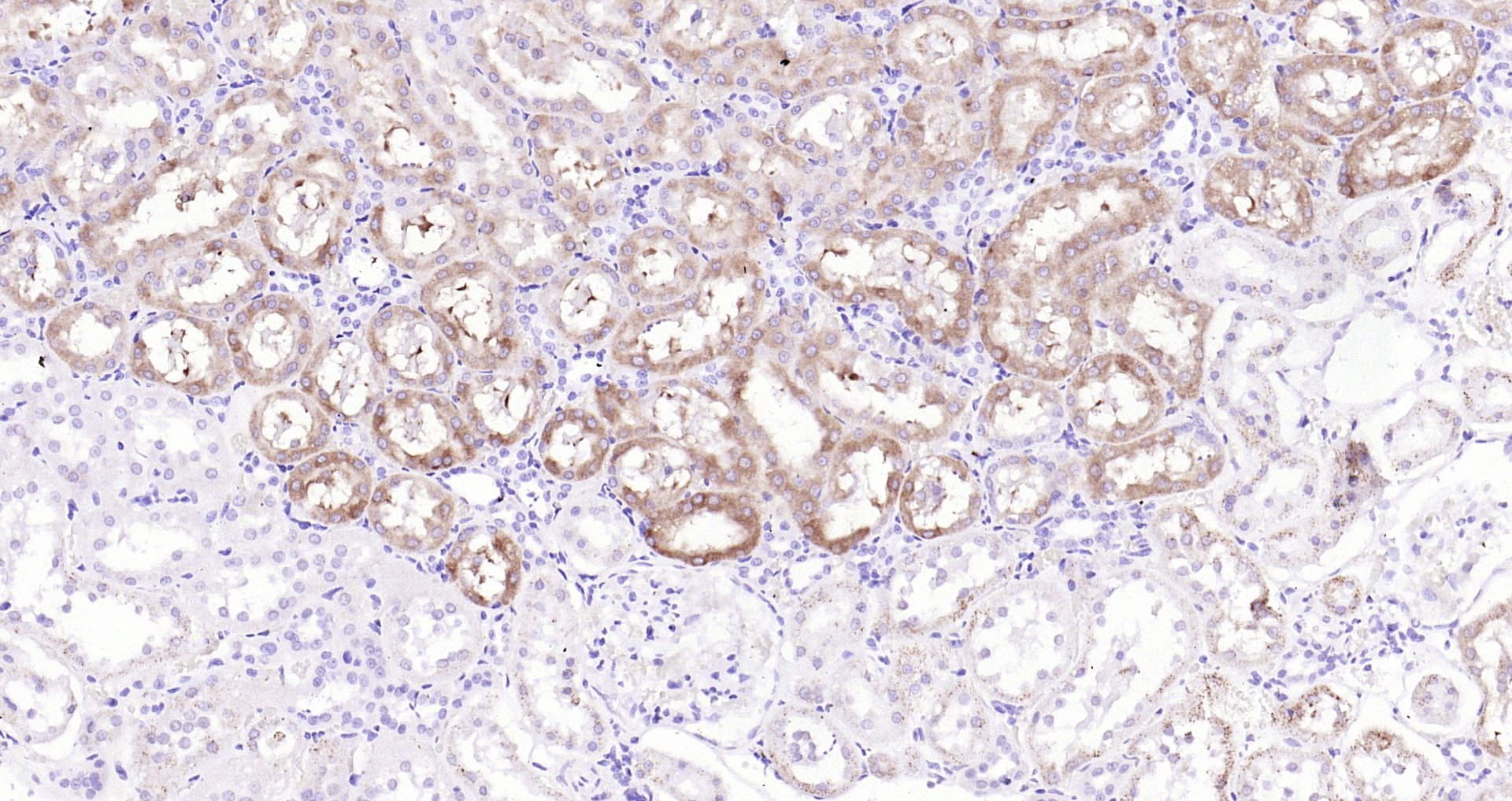 Paraformaldehyde-fixed, paraffin embedded Rat kidney; Antigen retrieval by boiling in sodium citrate buffer (pH6.0) for 15min; Block endogenous peroxidase by 3% hydrogen peroxide for 20 minutes; Blocking buffer (normal goat serum) at 37°C for 30min; Antibody incubation with IKK alpha Polyclonal Antibody, Unconjugated (bs-2907R) at 1:200 overnight at 4°C, DAB staining.