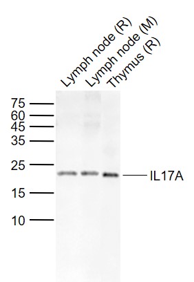Lane 1: Rat Lymph node tissue lysates; Lane 2: Mouse Lymph node tissue lysates; Lane 3: Rat Thymus tissue lysates probed with IL17A Polyclonal Antibody, Unconjugated (bs-1183R) at 1:1000 dilution and 4\u00b0C overnight incubation. Followed by conjugated secondary antibody incubation at 1:20000 for 60 min at 37˚C.