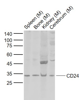 Lane 1: Mouse Spleen tissue lysates; Lane 2: Mouse Bone tissue lysates; Lane 3: Mouse Kidney tissue lysates; Lane 4: Mouse Cerebrum tissue lysates probed with CD24 Polyclonal Antibody, Unconjugated (bs-4891R) at 1:1000 dilution and 4°C overnight incubation. Followed by conjugated secondary antibody incubation at 1:20000 for 60 min at 37˚C.