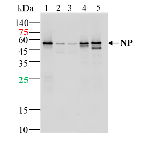 Lane 1: SARS-CoV-2 N protein(WT) at 10ng; Lane 2: SARS-CoV-2 N protein(Q9H, P67S, P80R, P151L, S183Y) at 2ng; Lane 3: SARS-CoV-2 N protein (D3L, P13T, D103Y, D128Y,H145Y, R203K, G204R, T205I, S235F) at 2ng; Lane 4: SARS-CoV-2 N protein (Del204 & Del215) at 2ng; Lane 5: SARS-CoV-2 N protein (R203M & D377Y) at 2ng probed with anti-SARS-CoV-2 N protein monoclonal antibody, Unconjugated (bsm-41481M) at 1:1000 dilution and 4\u2103 overnight incubation. Followed by conjugated secondary antibody incubation at 1:20000 for 60min at 37 \u2103.