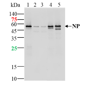 Lane 1: SARS-CoV-2 N protein(WT) at 10ng; Lane 2: SARS-CoV-2 N protein(Q9H, P67S, P80R, P151L, S183Y) at 2ng; Lane 3: SARS-CoV-2 N protein (D3L, P13T, D103Y, D128Y,H145Y, R203K, G204R, T205I, S235F) at 2ng; Lane 4: SARS-CoV-2 N protein (Del204 & Del215) at 2ng; Lane 5: SARS-CoV-2 N protein (R203M & D377Y) at 2ng probed with anti-SARS-CoV-2 N protein monoclonal antibody, Unconjugated (bsm-41481M) at 1:1000 dilution and 4℃ overnight incubation. Followed by conjugated secondary antibody incubation at 1:20000 for 60min at 37 ℃.