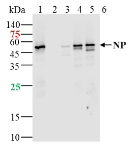 Lane 1: SARS-CoV-2 N protein(WT) at 10ng; Lane 2: SARS-CoV-2 N protein(Q9H, P67S, P80R, P151L, S183Y) at 2ng; Lane 3: SARS-CoV-2 N protein (D3L, P13T, D103Y, D128Y,H145Y, R203K, G204R, T205I, S235F) at 2ng; Lane 4: SARS-CoV-2 N protein (Del204 & Del215) at 2ng; Lane 5: SARS-CoV-2 N protein (R203M & D377Y) at 2ng probed with anti-SARS-CoV-2 N protein monoclonal antibody, Unconjugated (bsm-41511R) at 1:1000 dilution and 4\u2103 overnight incubation. Followed by conjugated secondary antibody incubation at 1:20000 for 60min at 37 \u2103