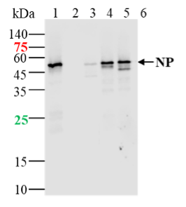 Lane 1: SARS-CoV-2 N protein(WT) at 10ng; Lane 2: SARS-CoV-2 N protein(Q9H, P67S, P80R, P151L, S183Y) at 2ng; Lane 3: SARS-CoV-2 N protein (D3L, P13T, D103Y, D128Y,H145Y, R203K, G204R, T205I, S235F) at 2ng; Lane 4: SARS-CoV-2 N protein (Del204 & Del215) at 2ng; Lane 5: SARS-CoV-2 N protein (R203M & D377Y) at 2ng probed with anti-SARS-CoV-2 N protein monoclonal antibody, Unconjugated (bsm-41511R) at 1:1000 dilution and 4℃ overnight incubation. Followed by conjugated secondary antibody incubation at 1:20000 for 60min at 37 ℃