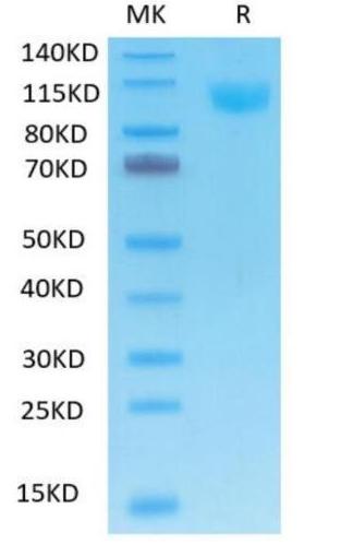 Recombinant human ACE2 on Tris-Bis PAGE under reduced condition. The purity is greater than 95%.