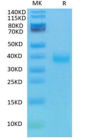 Recombinant SARS-CoV-2 protein RBD on Tris-Bis PAGE under reduced condition. The purity is greater than 95%.