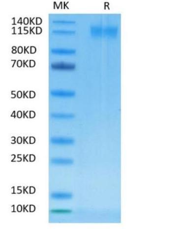 Recombinant SARS-CoV-2 Spike S1 protein on Tris-Bis PAGE under reduced condition. The purity is greater than 95%.