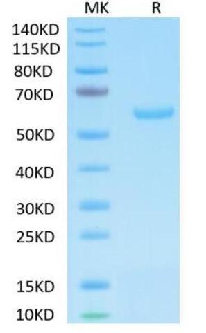 Recombinant SARS-CoV-2 S protein RBD on Tris-Bis PAGE under reduced condition. The purity is greater than 95%.