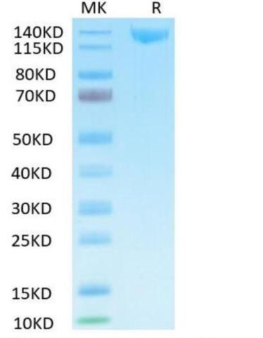 Recombinant SARS-CoV-2 Spike S1 protein on Tris-Bis PAGE under reduced condition. The purity is greater than 95%.