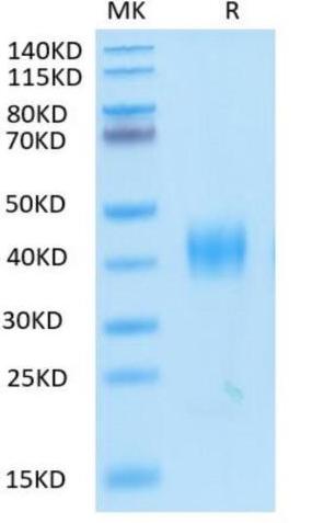 Recombinant SARS Spike RBD on Tris-Bis PAGE under reduced condition. The purity is greater than 95%.