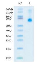 Recombinant SARS-CoV-2 Spike RBD protein on Tris-Bis PAGE under reduced condition. The purity is greater than 95%.