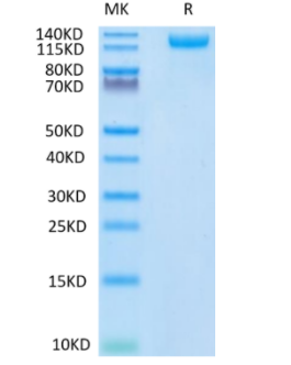 SARS-CoV-2 Spike S1 (N501Y) Protein on Tris-Bis PAGE under reduced condition. The purity is greater than 95%.