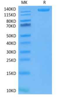 Recombinant SARS-COV-2 Spike S Trimer (D614G) Protein on Tris-Bis PAGE under reduced condition. The purity is greater than 95%.