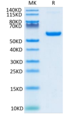 Recombinant 2019-nCoV S protein RBD on Tris-Bis PAGE under reduced condition. The purity is greater than 95%.