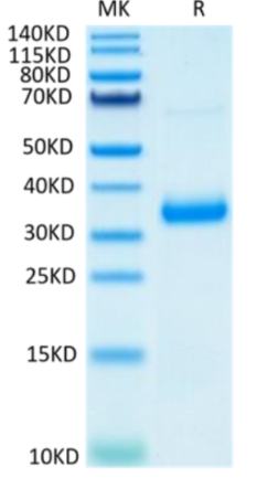 Recombinant SARS-CoV-2 Spike RBD (N501Y, K417N, E484K) on Tris-Bis PAGE under reduced condition. The purity is greater than 95%.