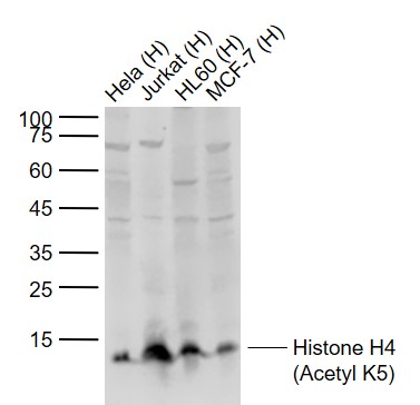 Lane 1: Human Hela cell lysates; Lane 2: Human Jurkat cell lysates; Lane 3: Human HL60 cell lysates; Lane 4: Human MCF-7 cell lysates probed with Histone H4 (Acetyl K5) Polyclonal Antibody, Unconjugated (bs-10721R) at 1:1000 dilution and 4°C overnight incubation. Followed by conjugated secondary antibody incubation at 1:20000 for 60 min at 37˚C.