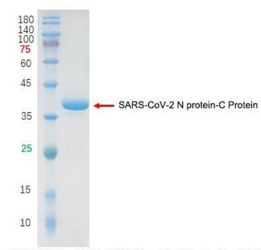 SDS-PAGE for rSARS-CoV-2 N protein-C Protein (bs-41409P)