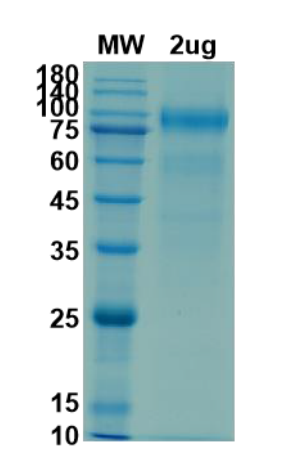 Recombinant Human ACE-2 protein on Tris-Bis PAGE\r\nunder reduced condition. The purity is greater than 90%.