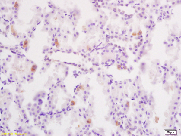 Formalin-fixed and paraffin embedded rat kidney tissue labeled with Anti-Phospho-YB1(Ser102) Polyclonal Antibody, Unconjugated (bs-3477R) at 1:200 followed by conjugation to the secondary antibody and DAB staining