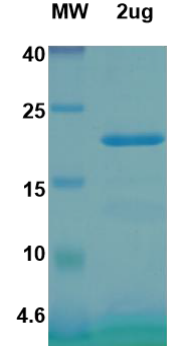Recombinant SARS-CoV-2 Spike protein fragment 2 on_x000D_ Tris-Bis PAGE under reduced condition. The purity is greater than 90%.