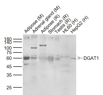 Lane 1: Mouse Adipose tissue lysates; Lane 2: Mouse Adrenal gland tissue lysates; Lane 3: Rat Adipose tissue lysates; Lane 4: Rat Stomach tissue lysates ; Lane 5: Rat Testis tissue lysates ; Lane 6: Human HL60 cell lysates; Lane 7: Human HepG2 cell lysates probed with DGAT1 Polyclonal Antibody, Unconjugated (bs-2332R) at 1:300 dilution and 4°C overnight incubation. Followed by conjugated secondary antibody incubation at 1:20000 for 60 min at 37˚C.