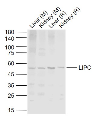 Lane 1: Mouse Liver tissue lysates; Lane 2: Mouse Kidney tissue lysates; Lane 3: Rat Liver tissue lysates; Lane 4: Rat Kidney tissue lysates probed with LIPC Polyclonal Antibody, Unconjugated (bs-18288R) at 1:1000 dilution and 4°C overnight incubation. Followed by conjugated secondary antibody incubation at 1:20000 for 60 min at 37˚C.