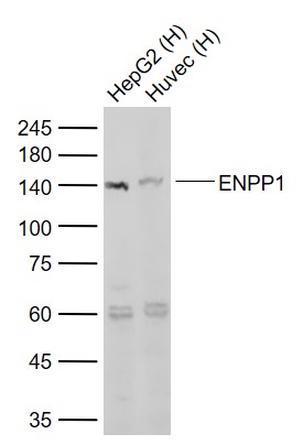 Lane 1: Human HepG2 cell lysates; Lane 2: Human Huvec cell lysates probed with ENPP1 Polyclonal Antibody, Unconjugated (bs-1760R) at 1:1000 dilution and 4°C overnight incubation. Followed by conjugated secondary antibody incubation at 1:20000 for 60 min at 37˚C.