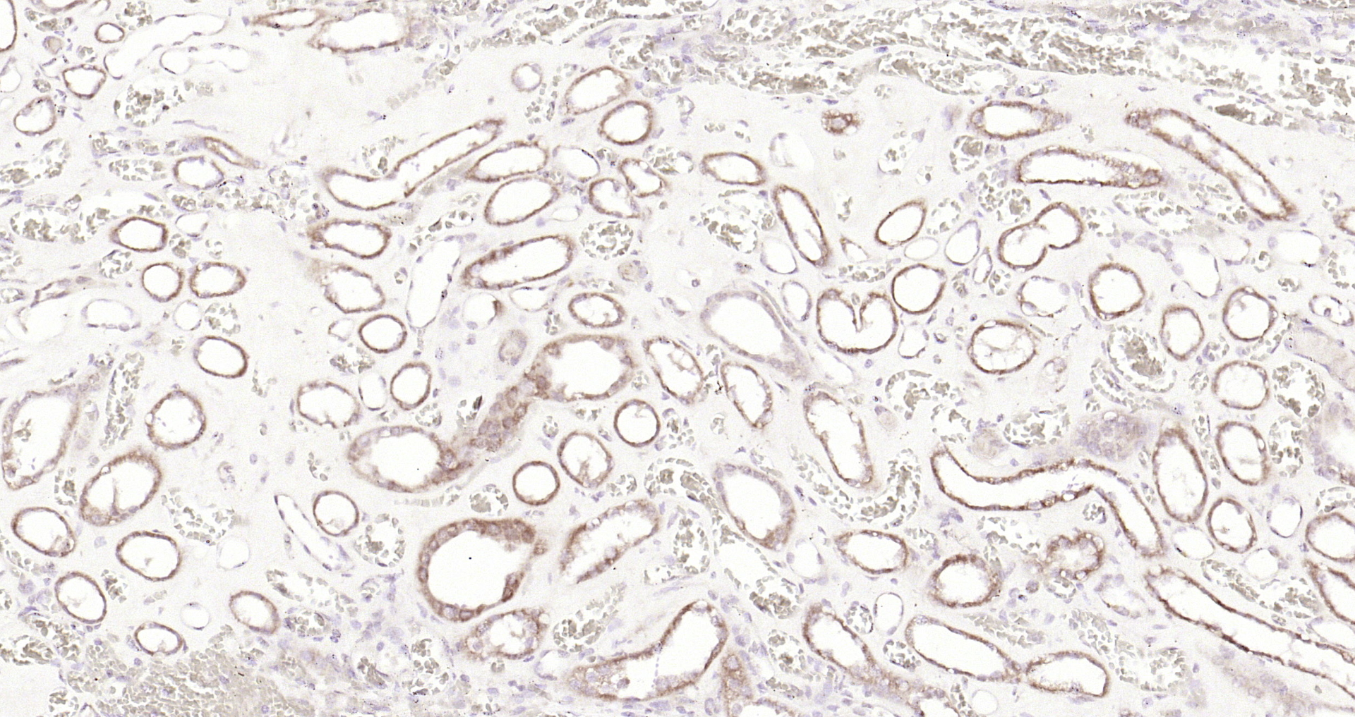 Paraformaldehyde-fixed, paraffin embedded Human kidney; Antigen retrieval by boiling in sodium citrate buffer (pH6.0) for 15min; Block endogenous peroxidase by 3% hydrogen peroxide for 20 minutes; Blocking buffer (normal goat serum) at 37°C for 30min; Antibody incubation with DPAGT1 Polyclonal Antibody, Unconjugated (bs-14412R) at 1:200 overnight at 4°C, DAB staining.