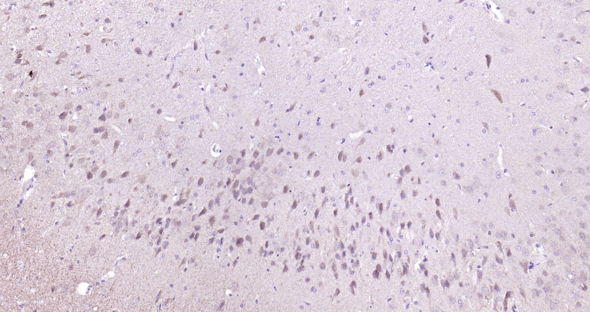 Paraformaldehyde-fixed, paraffin embedded Mouse brain; Antigen retrieval by boiling in sodium citrate buffer (pH6.0) for 15min; Block endogenous peroxidase by 3% hydrogen peroxide for 20 minutes; Blocking buffer (normal goat serum) at 37°C for 30min; Antibody incubation with Adenylosuccinate Lyase Polyclonal Antibody, Unconjugated (bs-6352R) at 1:200 overnight at 4°C, DAB staining.