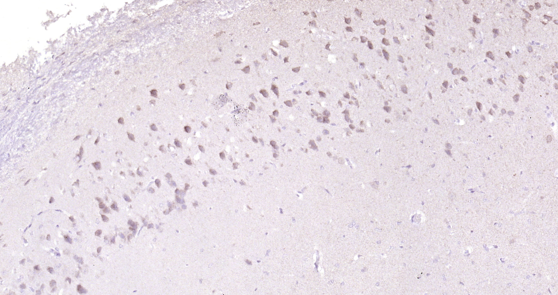 Adenylosuccinate Lyase Antibody – Bioss