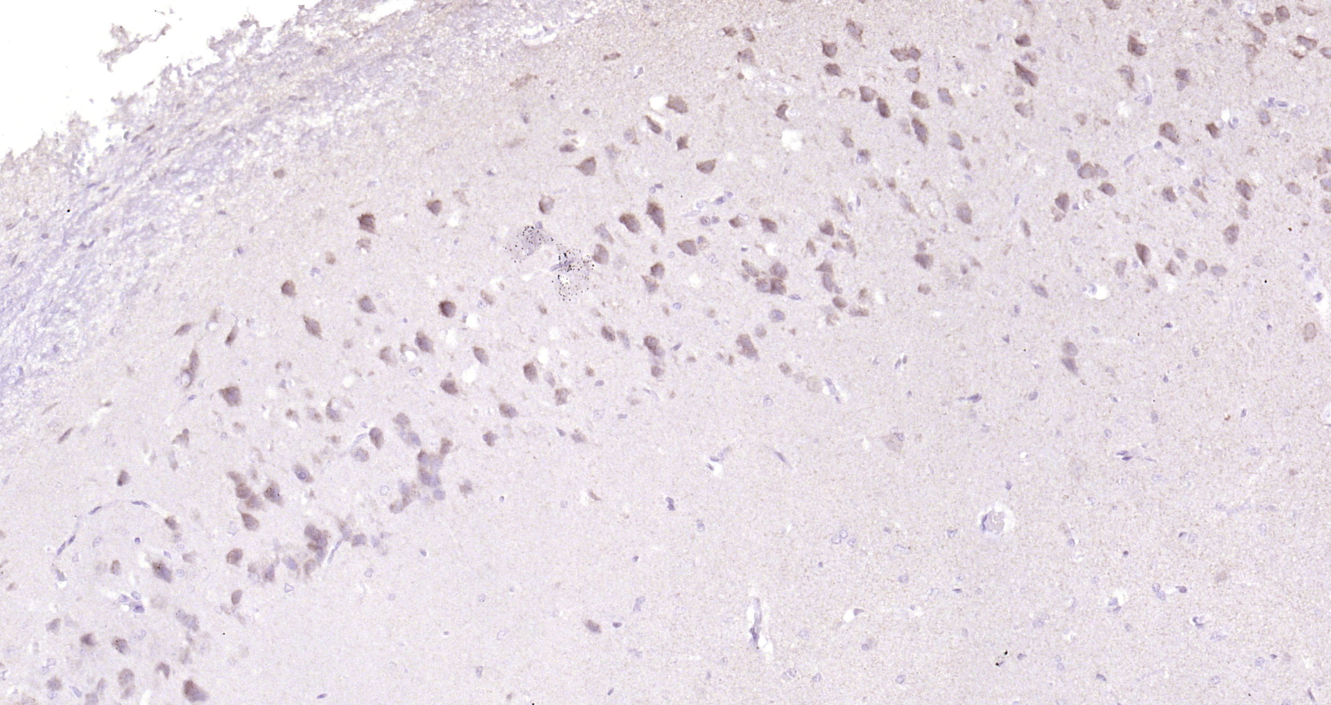 Paraformaldehyde-fixed, paraffin embedded Rat brain; Antigen retrieval by boiling in sodium citrate buffer (pH6.0) for 15min; Block endogenous peroxidase by 3% hydrogen peroxide for 20 minutes; Blocking buffer (normal goat serum) at 37°C for 30min; Antibody incubation with Adenylosuccinate Lyase Polyclonal Antibody, Unconjugated (bs-6352R) at 1:200 overnight at 4°C, DAB staining.